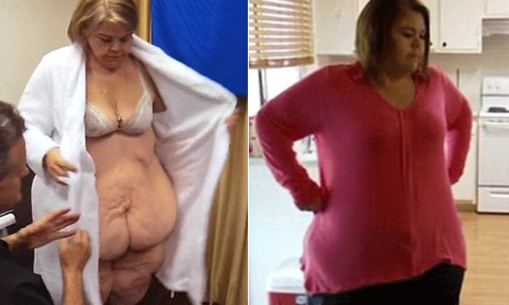 Man left Woman becaiuse she lost weight