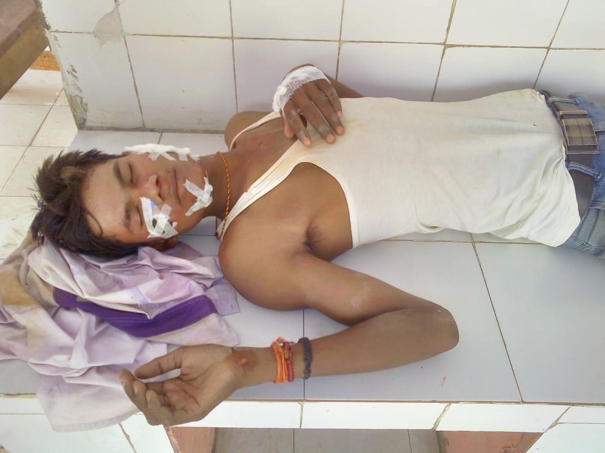 Four injured in accident, a serious