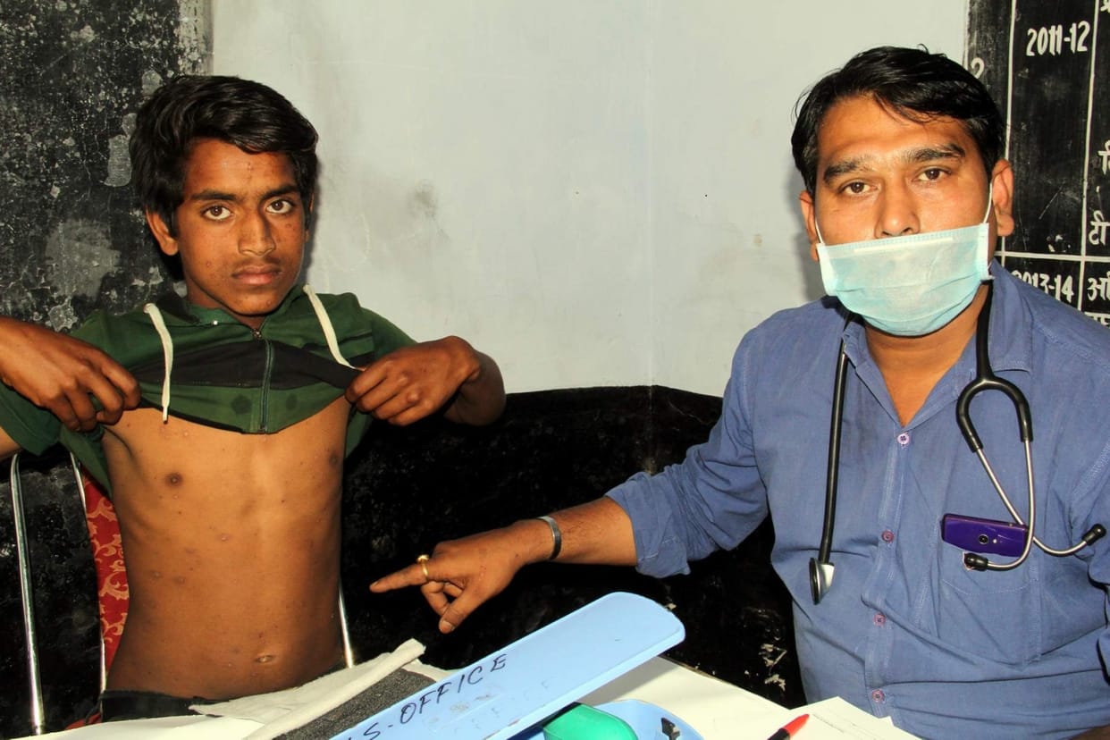 increases the risk of chicken pox in Kunja grant.