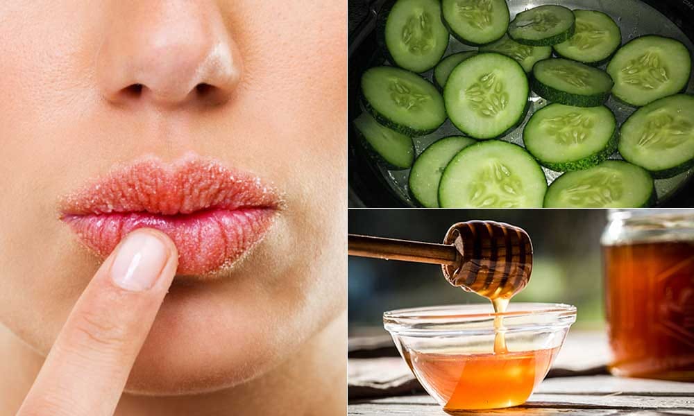Tips to cure dry lips in summers