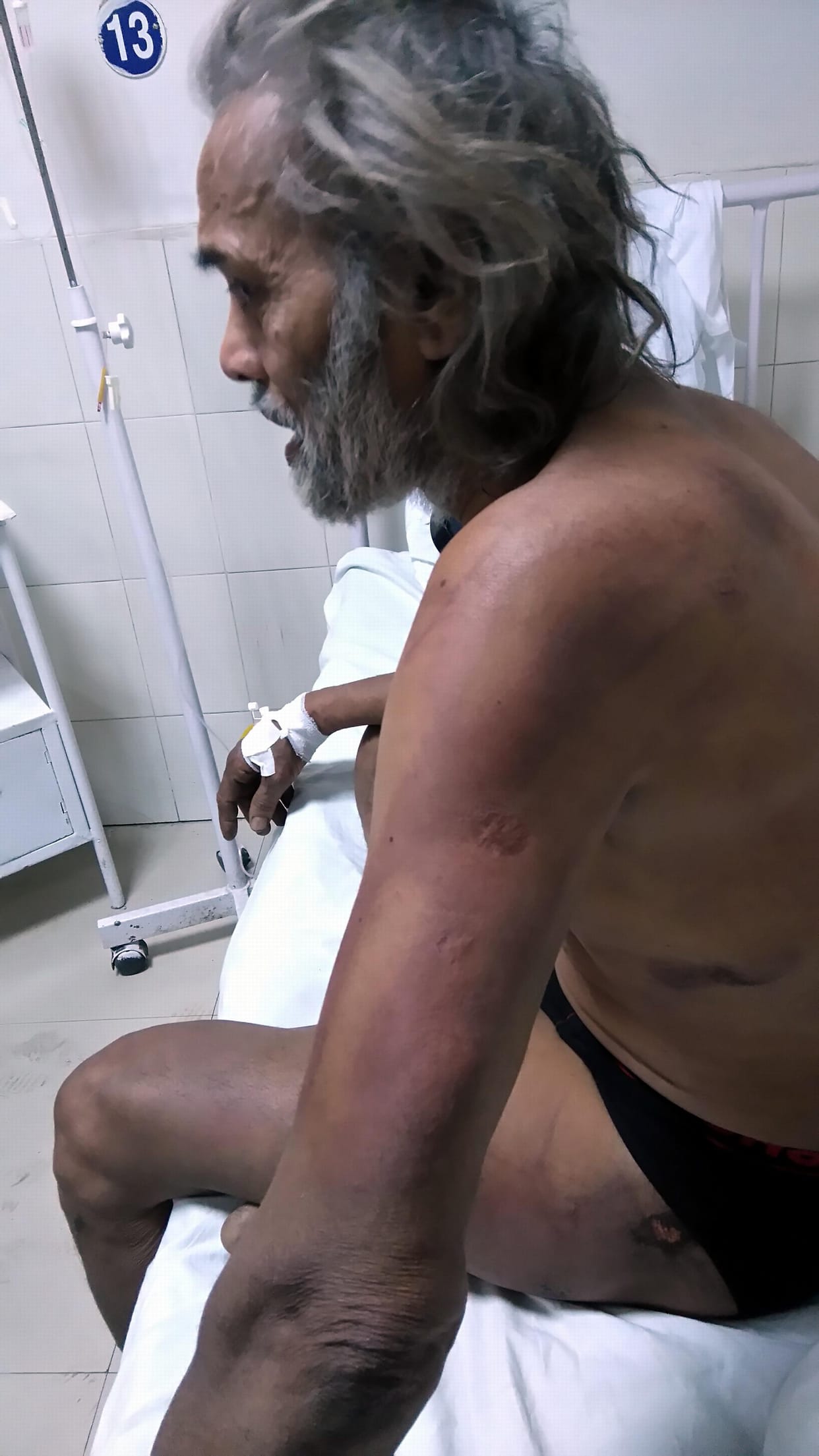 police beaten up priest 