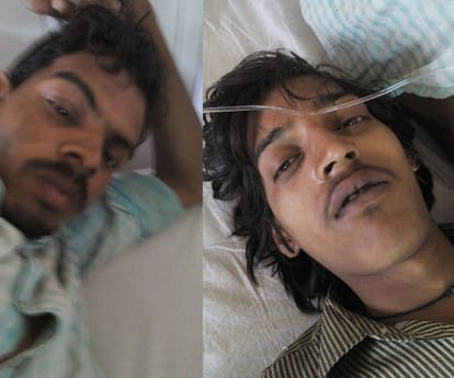 25 people fall ill after eating pulse.