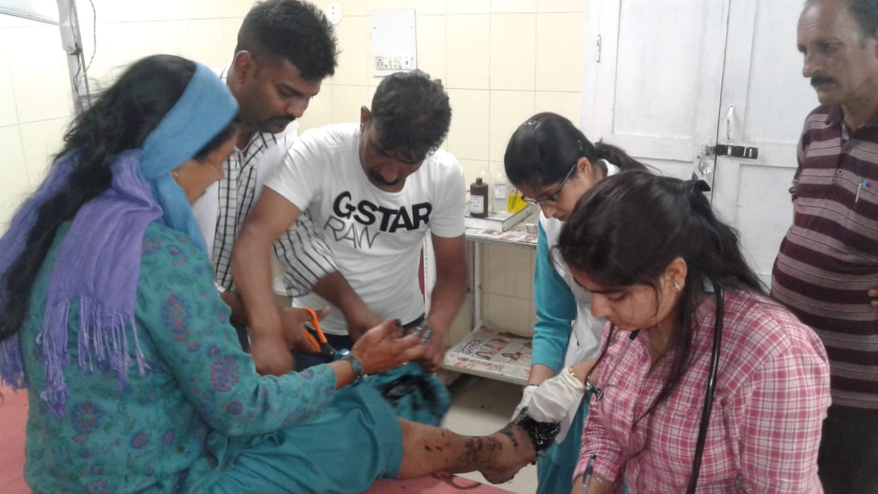 pwd worker burned