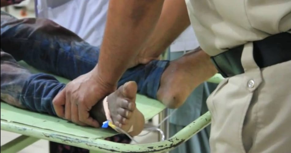 crime, man cut rapist arms, horrible punishment to rapist, child rape