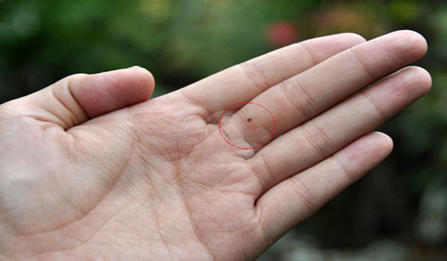 know which mole on your hand is auspicious-and-which are inauspicious