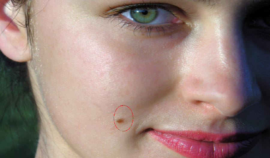 astrology Meaning of women being mole in these places