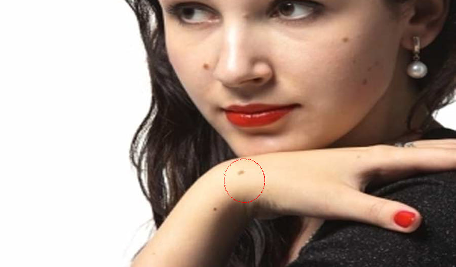 palmistry mole and money