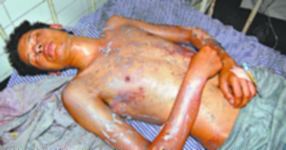 Mohali PG cracked cylinder , 6 youth scorched See Photos