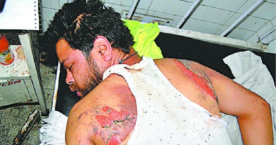 Mohali PG cracked cylinder , 6 youth scorched See Photos