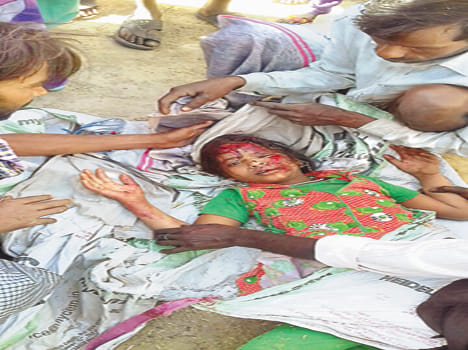 Truck collision killed the brother, sister injured