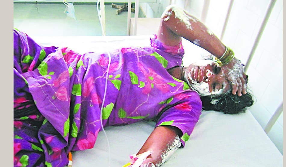 Married burnt for dowry death