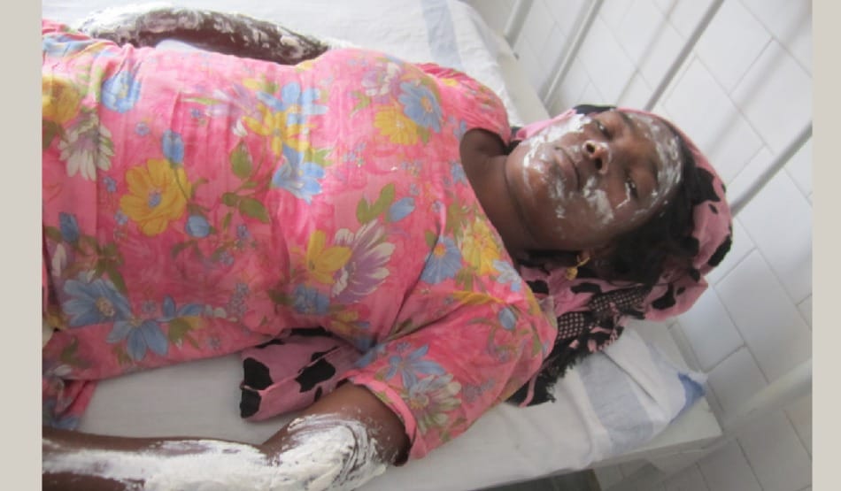 brutal incident: fire on crop of wheat, 4 womens burn in incident in barnala