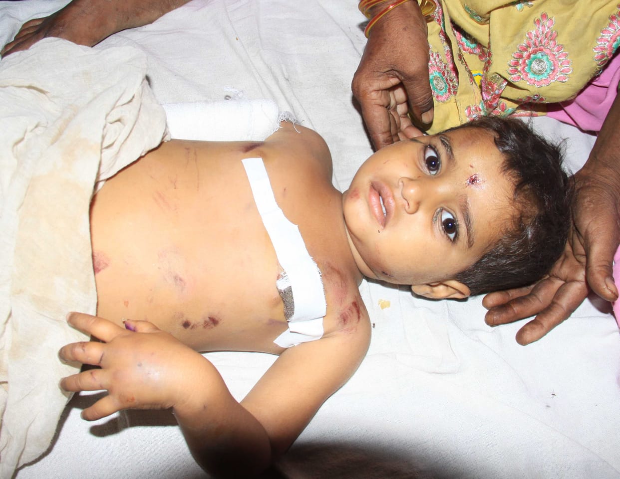 Pig child wounded in the attack, had jammed