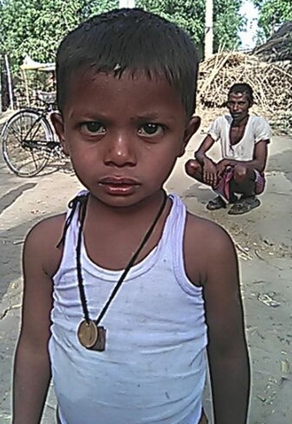 Four villages vulnerable to measles, 24 ill