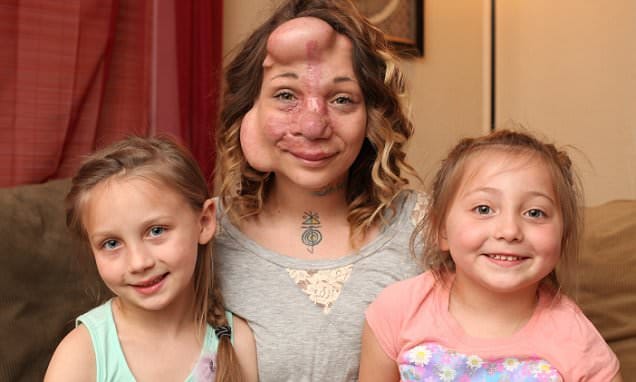 balloons inside face to get beauty 