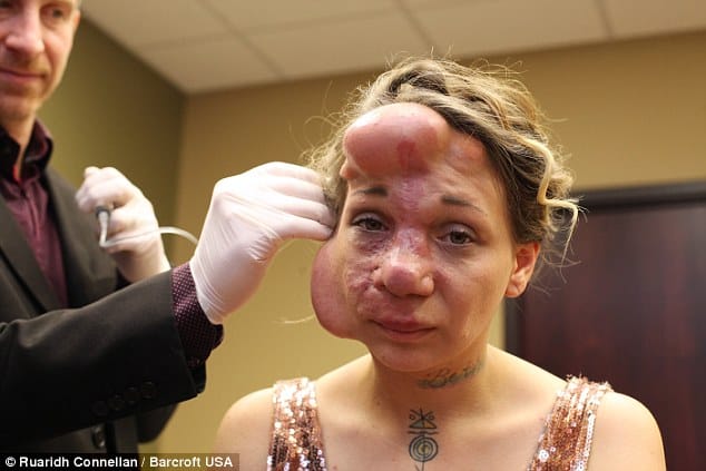 balloons inside face to get beauty 