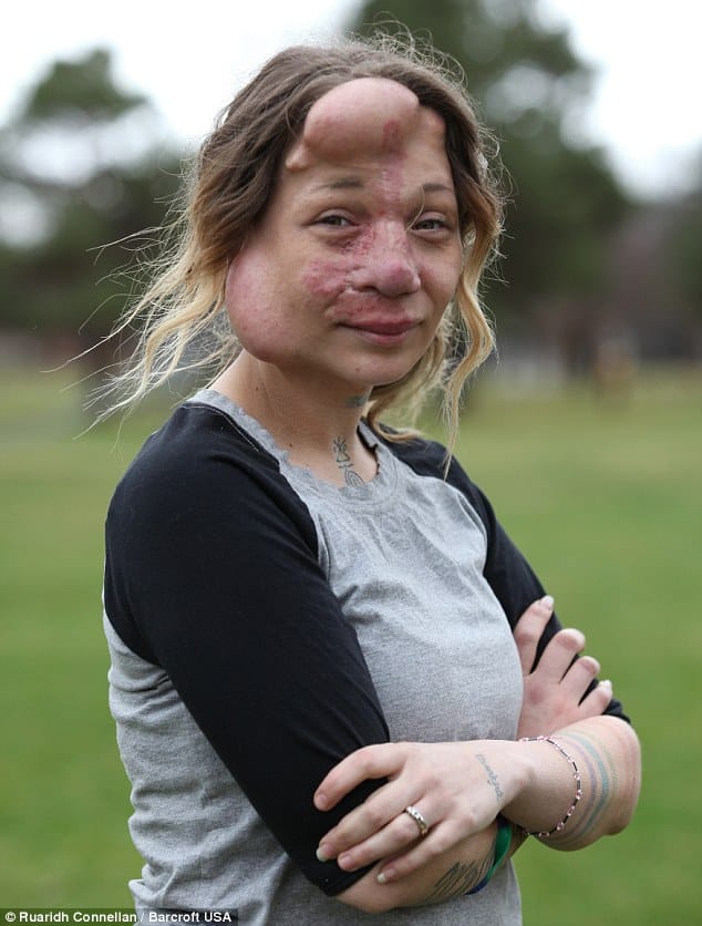 balloons inside face to get beauty 