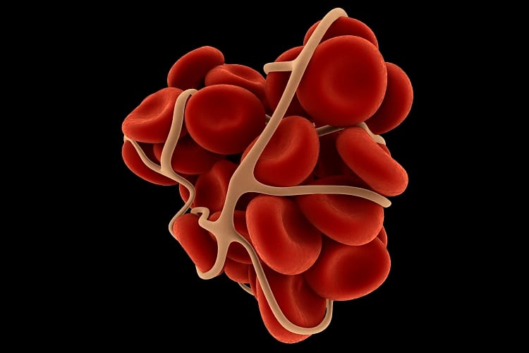government make policy for eliminate of Haemophilia