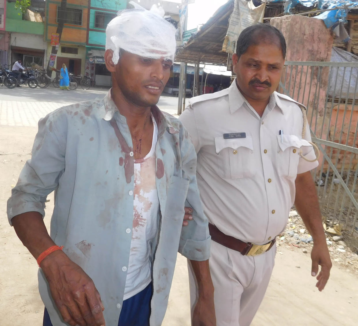 The injured, including the uncle
