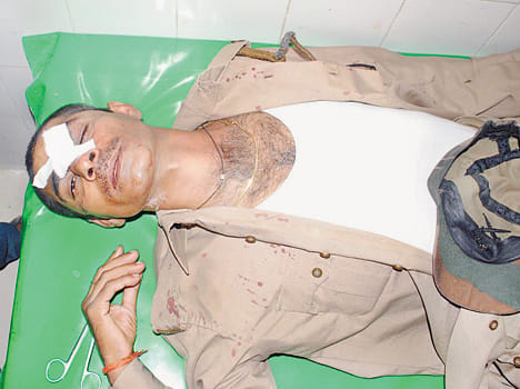 Dbangon beaten Home Guards