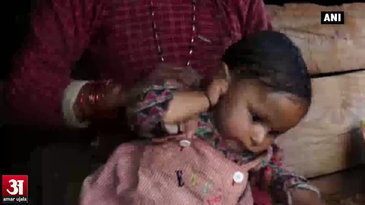 Lil Saharanpur old childhood malnutrition