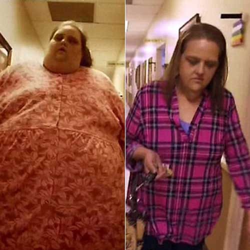 Extra mass removed from woman of 181 kg
