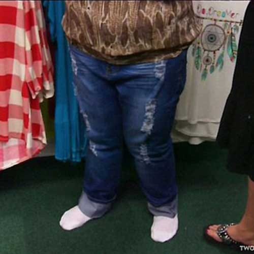 Extra mass removed from woman of 181 kg
