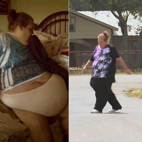 Extra mass removed from woman of 181 kg