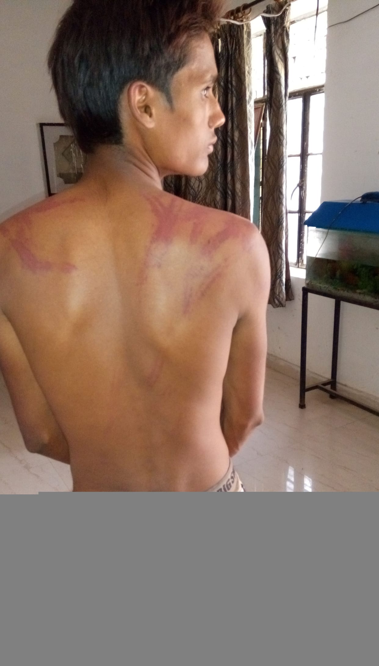 Tent House-Dudhakr ran three workers beaten, injured