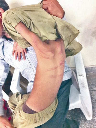 boy brutely beated in agra