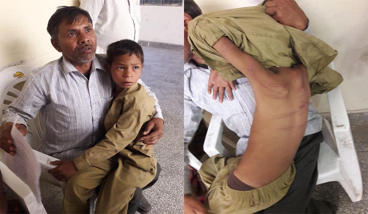 Teacher mercilessly beaten class 10 student 