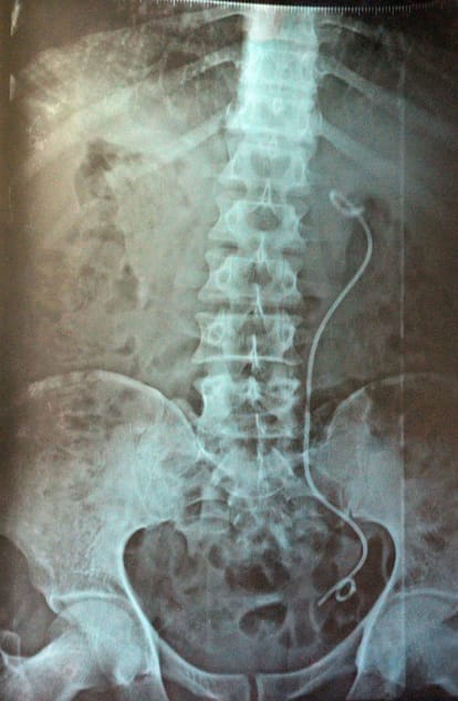carelessness of lucknow doctors