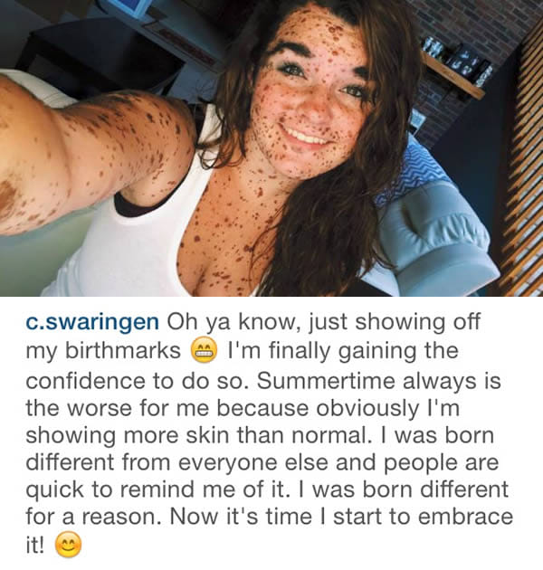 weird bodies and birthmarks