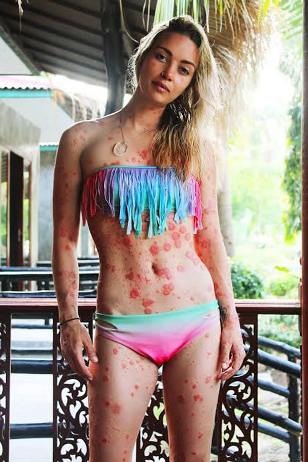 weird bodies and birthmarks
