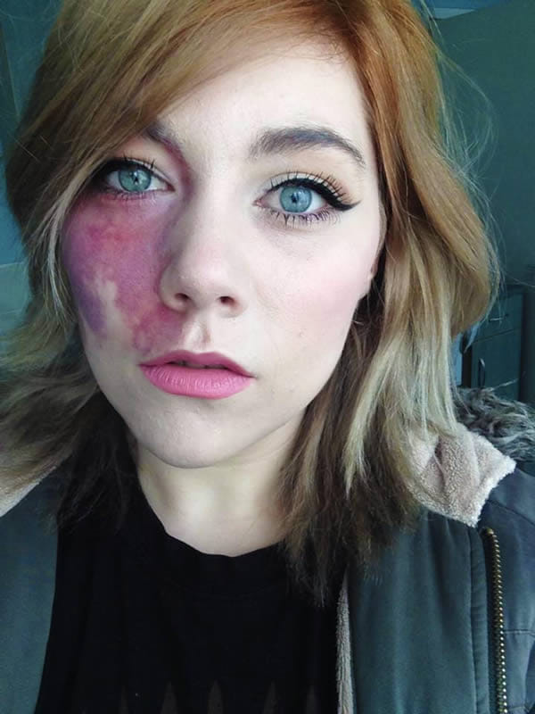 weird bodies and birthmarks