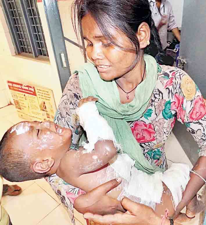 After sparking wire breaks down , burnt two girls