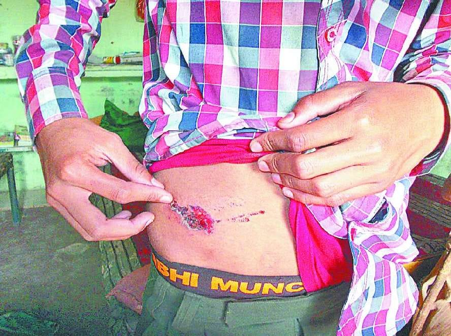 Sirsa News, Hindi News, Crime, Father Beat son for liquer, wounded, Sirsa