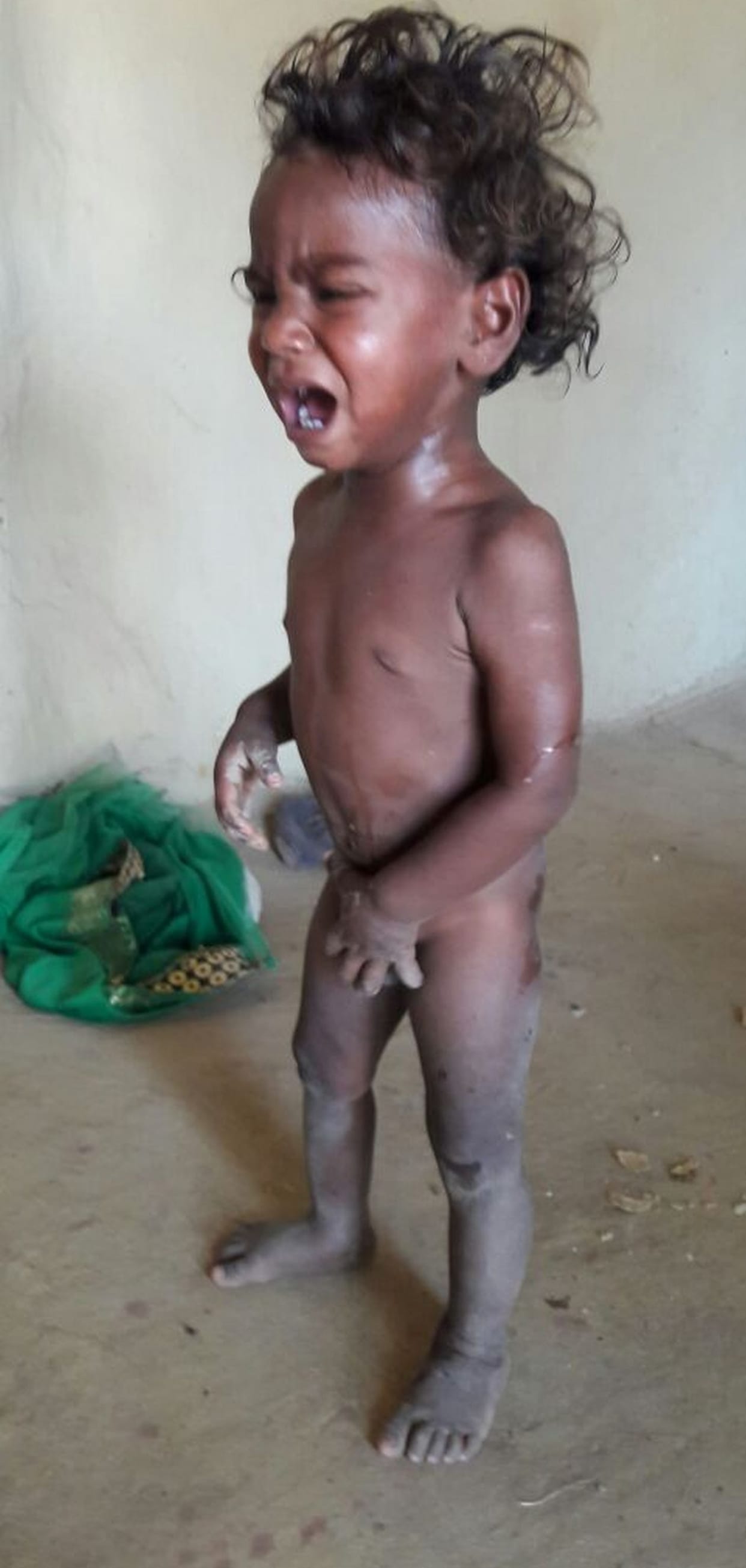Every third child in the family Atikuposhit