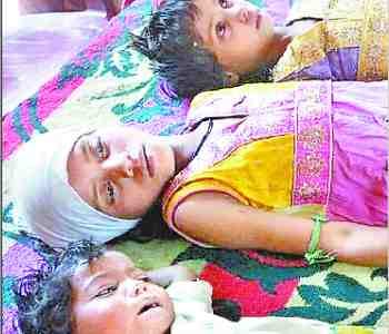 29 children suffering from measles