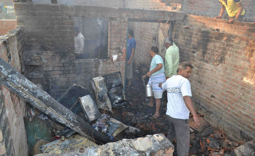 RS boy brother burned