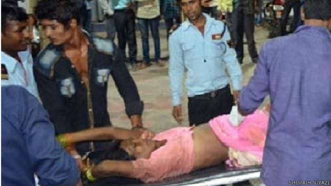 seven women lost their legs in accident