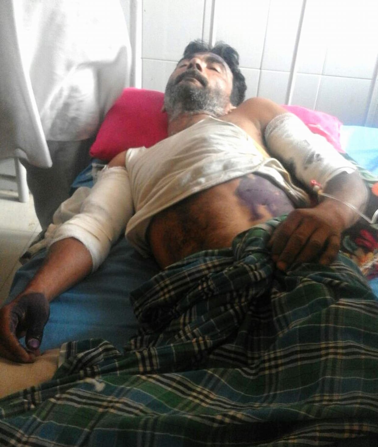 dogs attack on farmer.