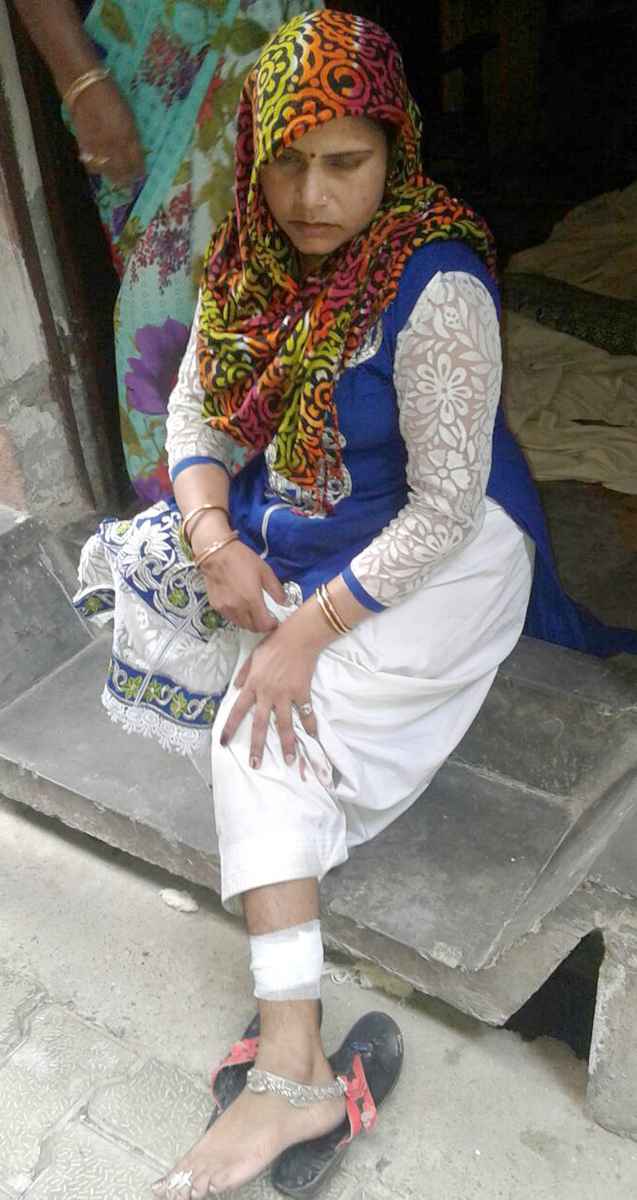 Monkey attacks woman Wounded.