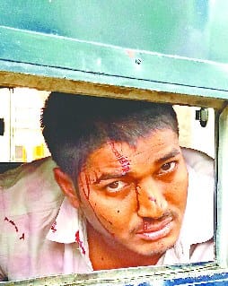  Rampur muscle from head to come to the boil captive vehicle , commotion