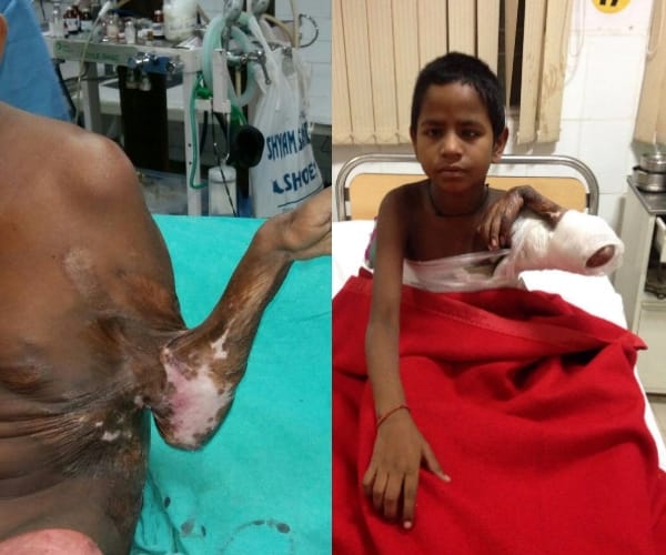 Surgery in Balrampur hospital.
