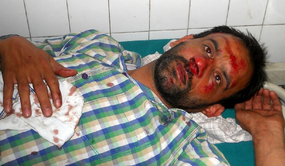 collision between 3 bike on highway, 1 dead, 2 injured