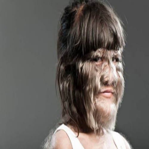why supatra is called monkey face girl?