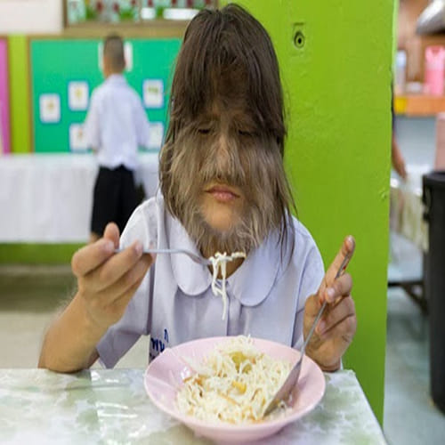 why supatra is called monkey face girl?