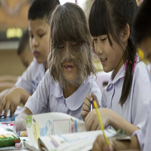 why supatra is called monkey face girl?