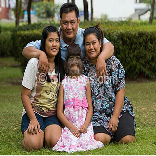 why supatra is called monkey face girl?